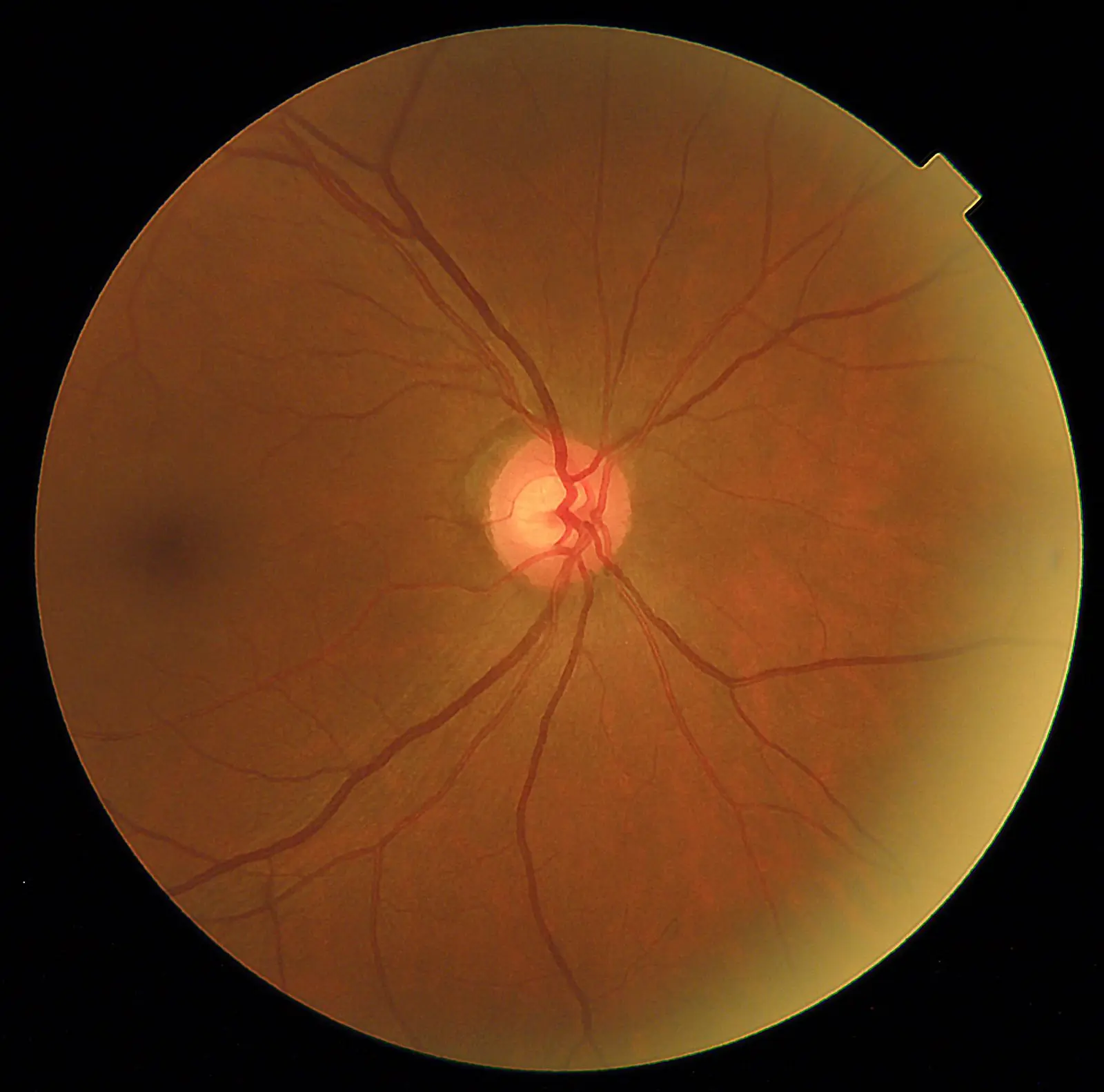 MyDr-Detection